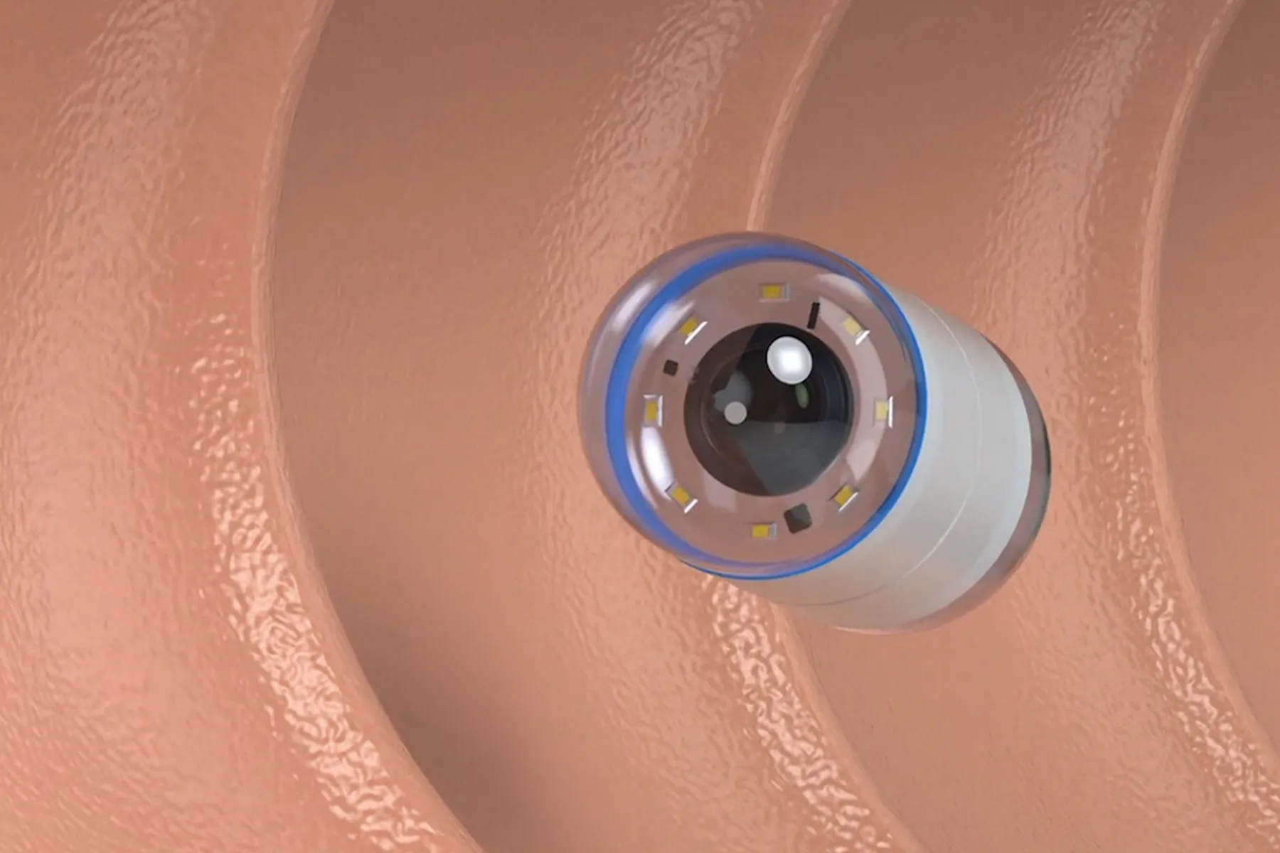 Would you swallow a pill sized drone 