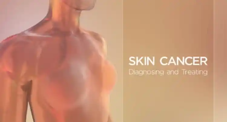 How Skin Cancer Develops