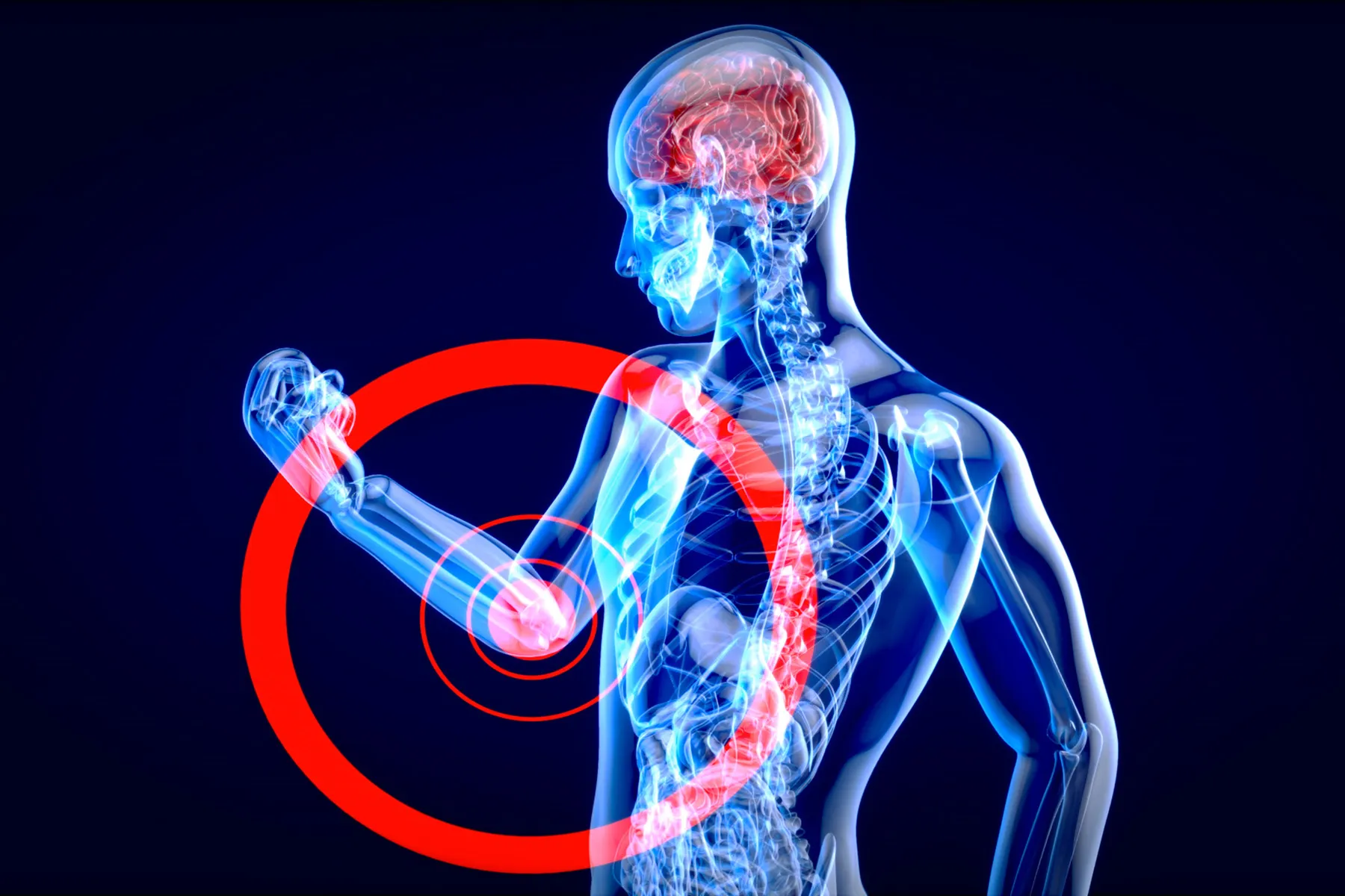 Treating Both Skin and Joints for Psoriatic Arthritis