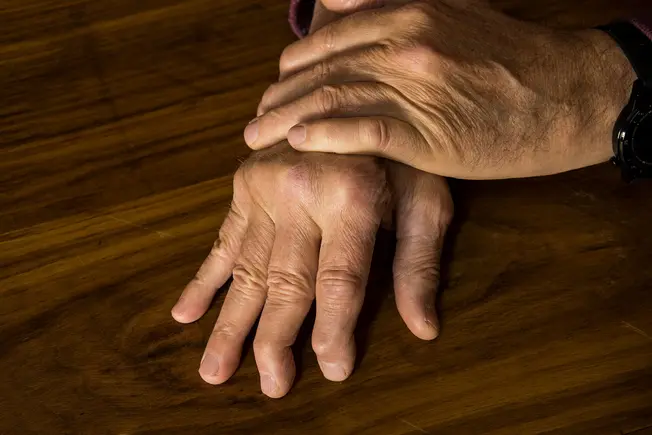 What Is Psoriatic Arthritis?