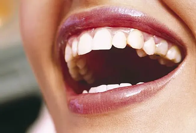 Want Brighter, Whiter Teeth?