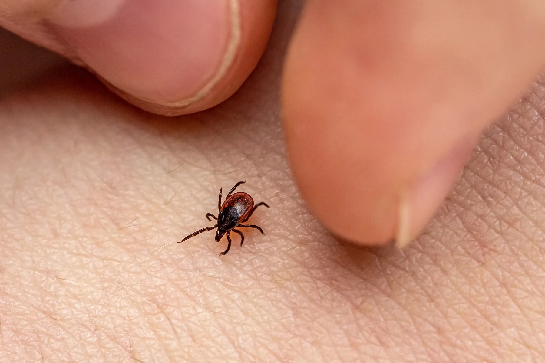 Tick-Borne Powassan Virus Can Kill — How  to Protect Yourself