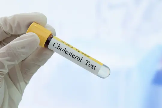 photo of Cholesterol Test