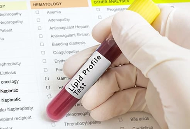 What's a Lipid Profile?