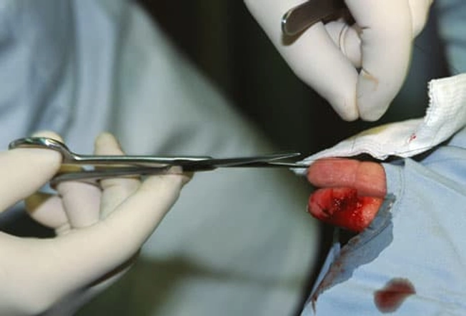 Watch Surgical Wounds for Infection