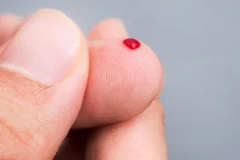 Finger-Prick Blood Take a look at Promising for Alzheimer’s Prognosis