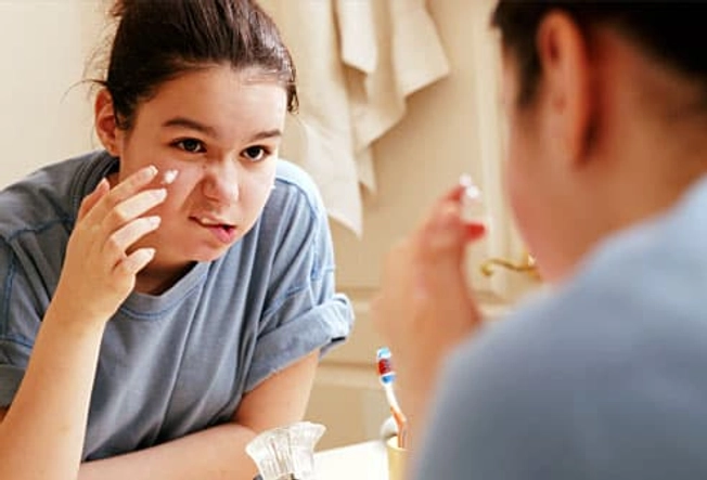 How to Treat Acne