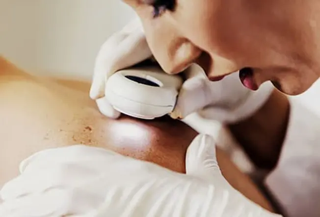 Changes in Your Skin