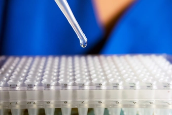 Stem Cell Transplant