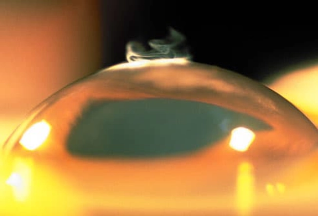 Refractive Eye Surgery
