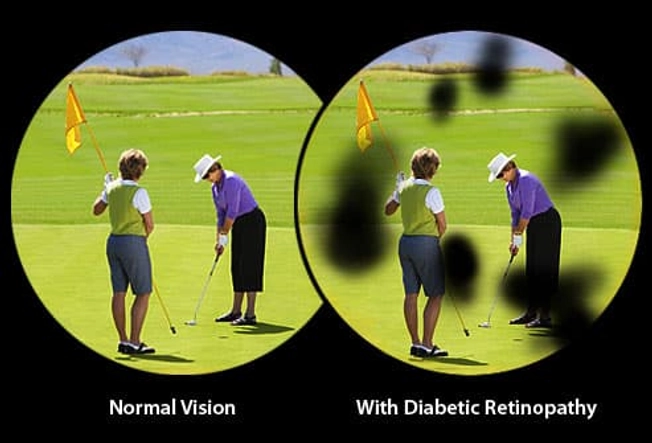 You're Losing Your Sight
