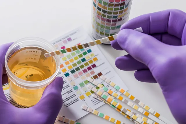 What to Consider When Getting a Drug Test