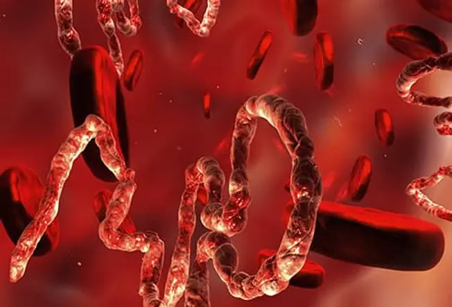 What is Ebola?