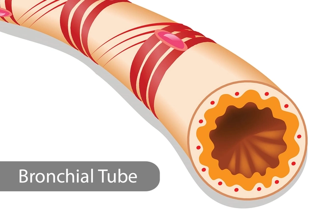 72 Hours: Bronchial Tubes 72 Hours: Bronchial Tubes
