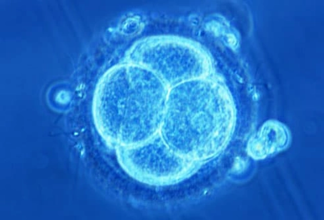 Endometriosis and Infertility