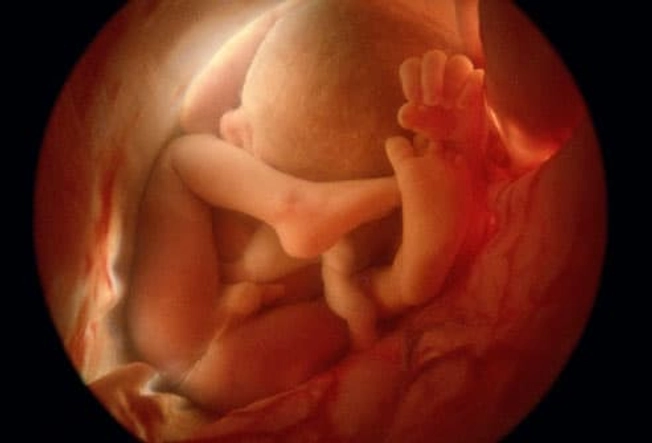 Development at 36 Weeks