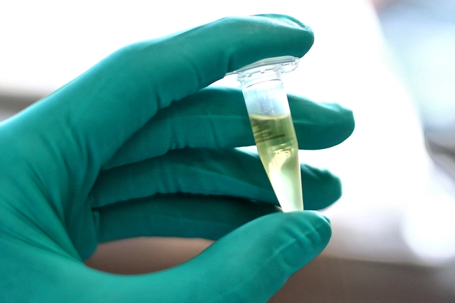 CSF Test Results