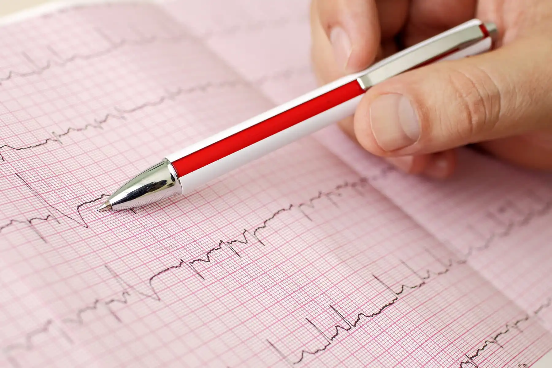 checking ecg readout