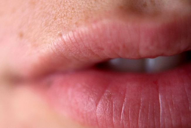 Tingle vs. Allergy