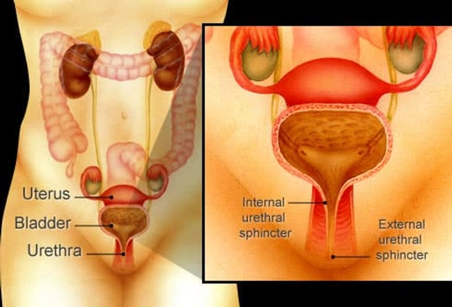 Stress Incontinence: Causes