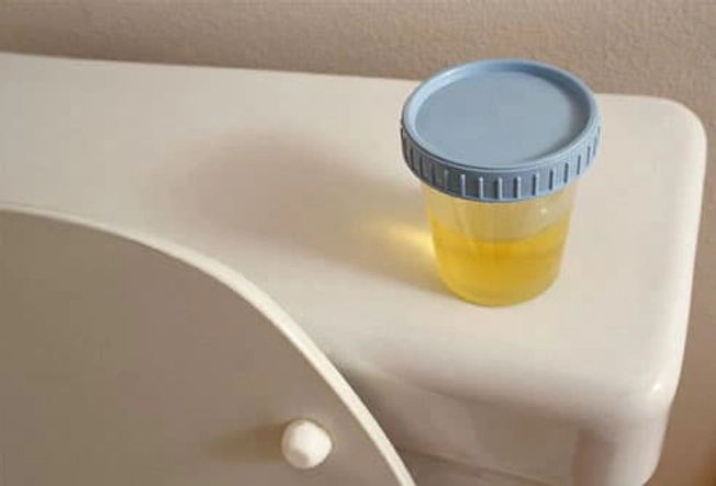 Diagnosing Incontinence