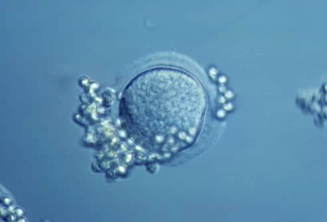 IVF With a Donor Egg