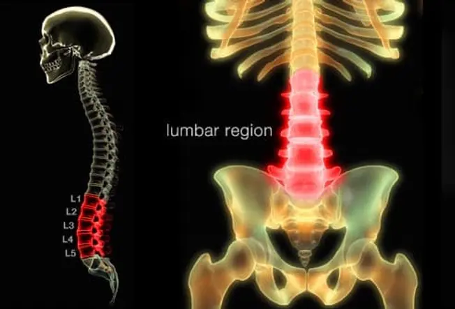 What Is Low Back Pain?