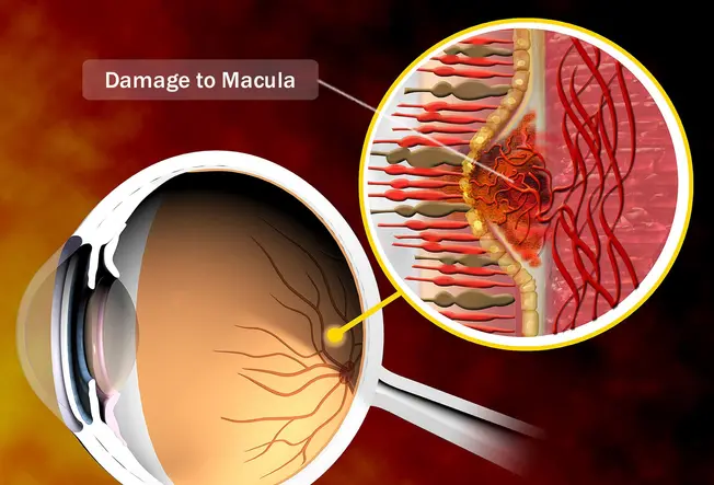Your Macula