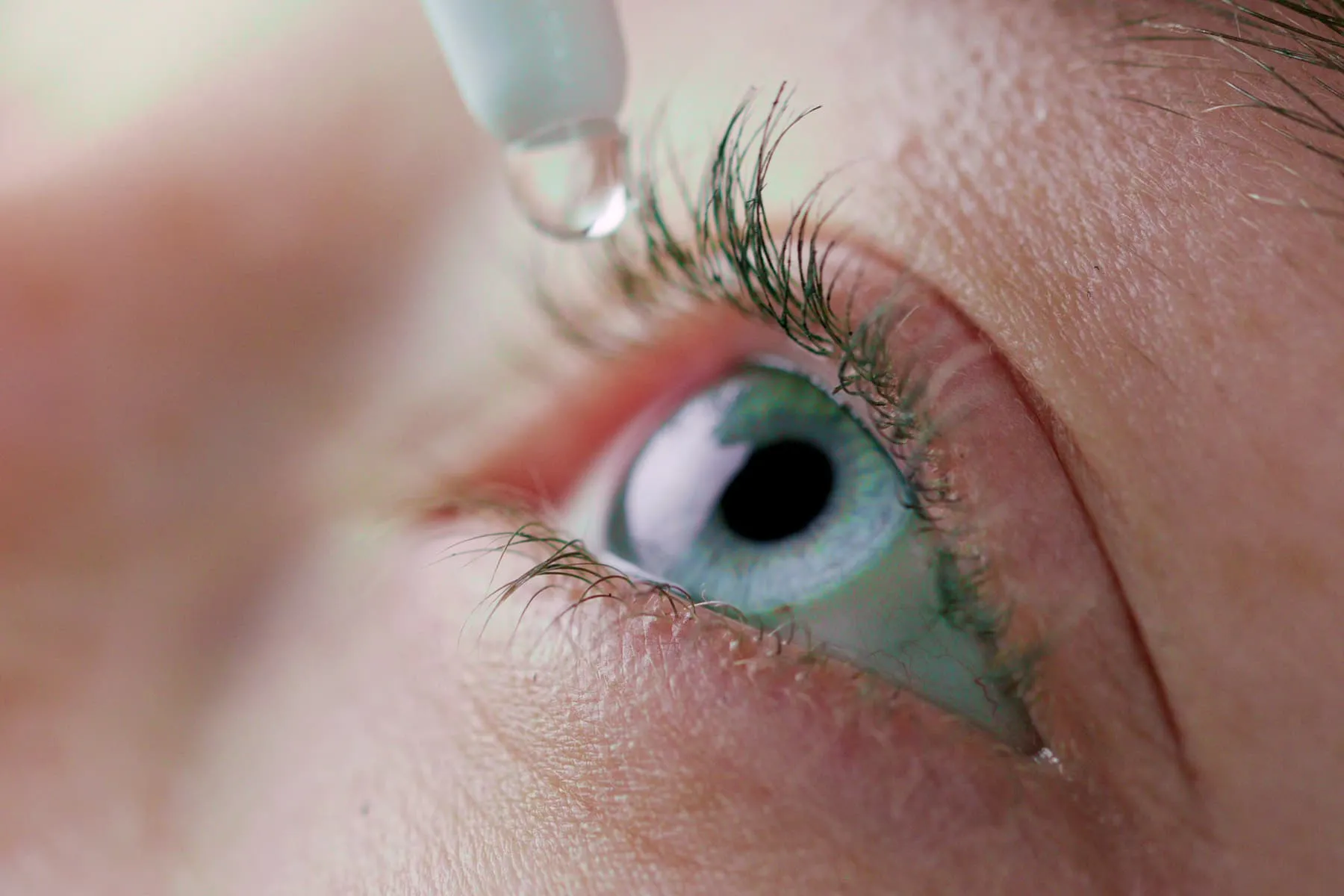 Recalled Eye Drops Lead to More Deaths, Removals of Eyes