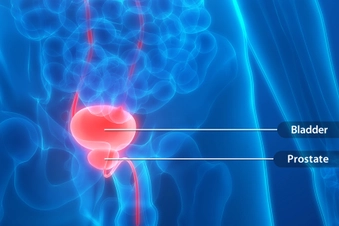 Fact: It's Not Always a Prostate Problem