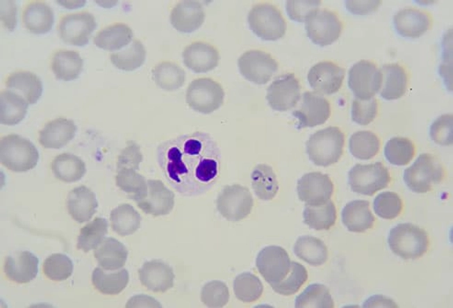 P. Falciparum