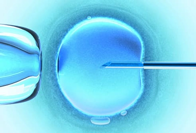 Infertility Treatment