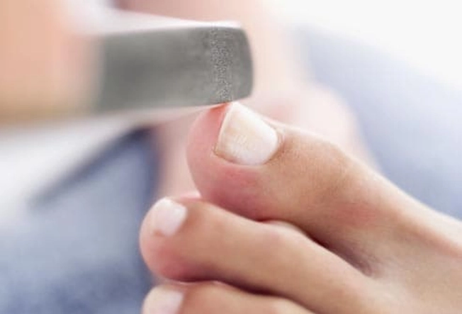 Do Trim Toenails Right