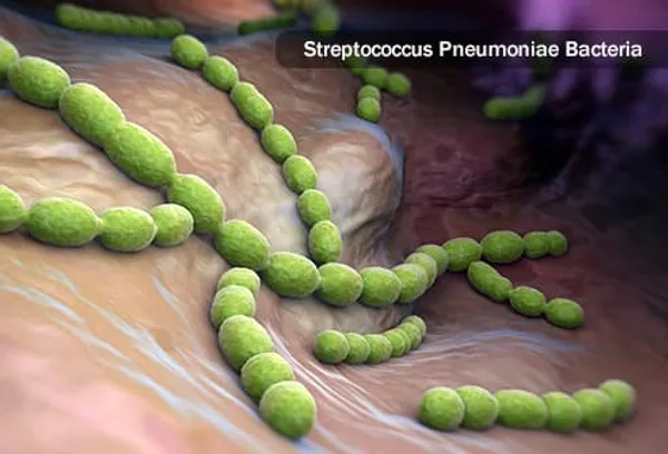 streptococcus pneumoniae bakterisi