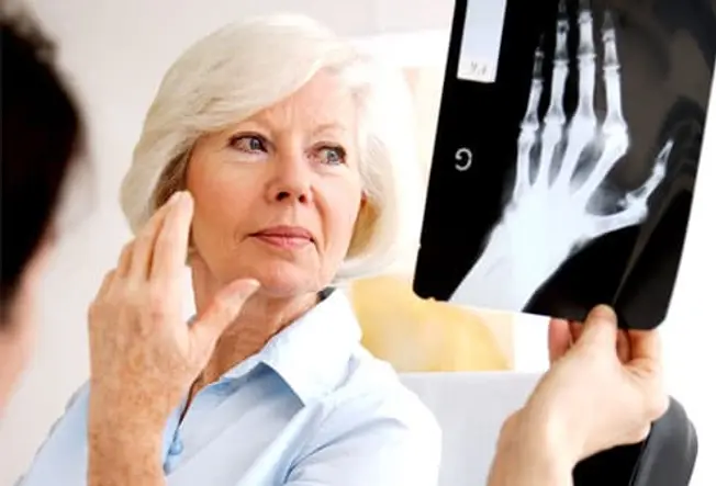 What Is Rheumatoid Arthritis (RA)?