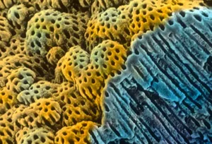 SEM Image of Dentin