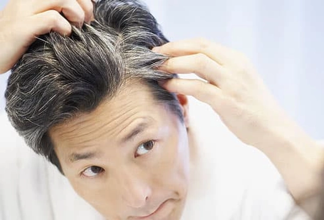 Premature Gray Hair Is Genetic