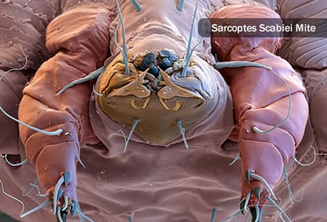 Skin Parasites