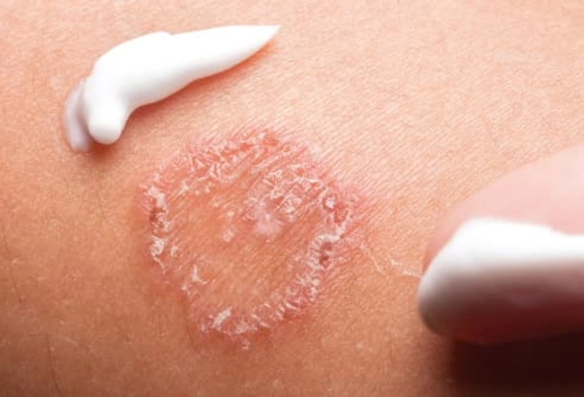How Are Skin Infections Treated?