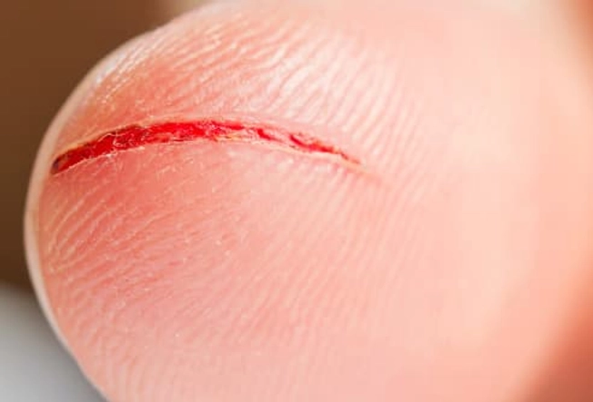 How Does Your Skin Get Infected?