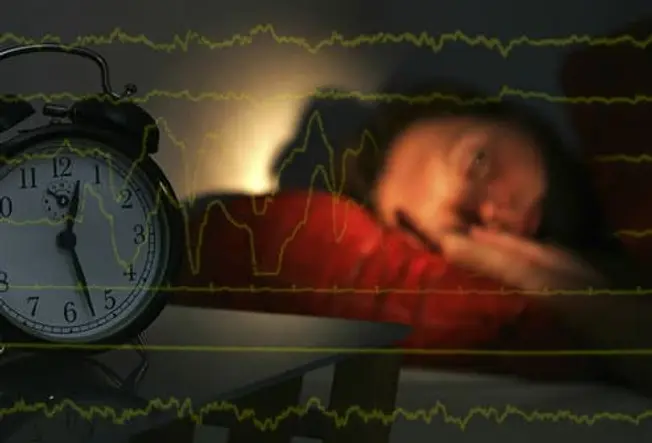 What Are Sleep Disorders?