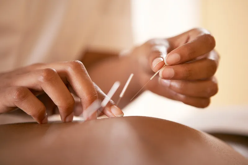 Why I Don’t Use Complementary Treatments for Migraine