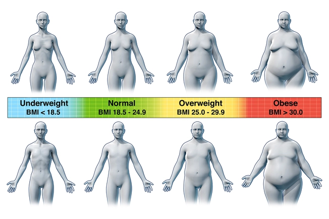 Be Careful With BMI