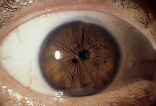 Polycoria