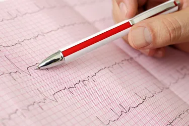 If you have symptoms of an arrhythmia, your doctor may refer you to an electrophysiologist to help determine its cause. (Photo credit: iStock/Getty Images)