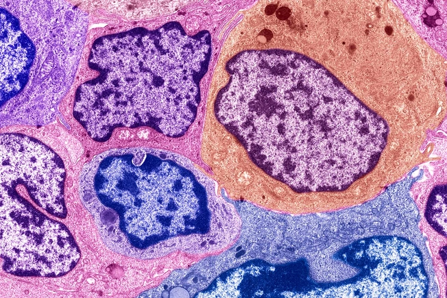 Cancer Isn’t One-Size-Fits-All