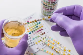 urine test