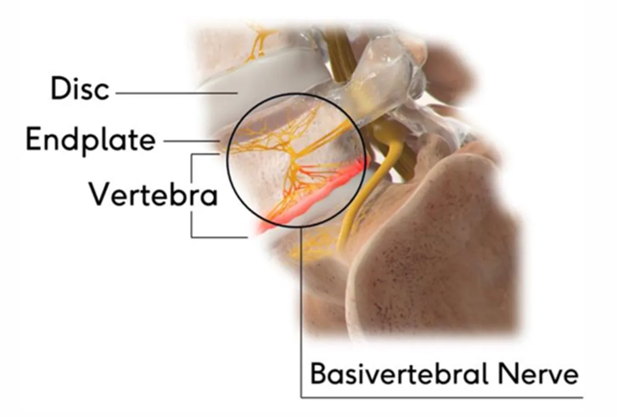 WebMD - BVN Image