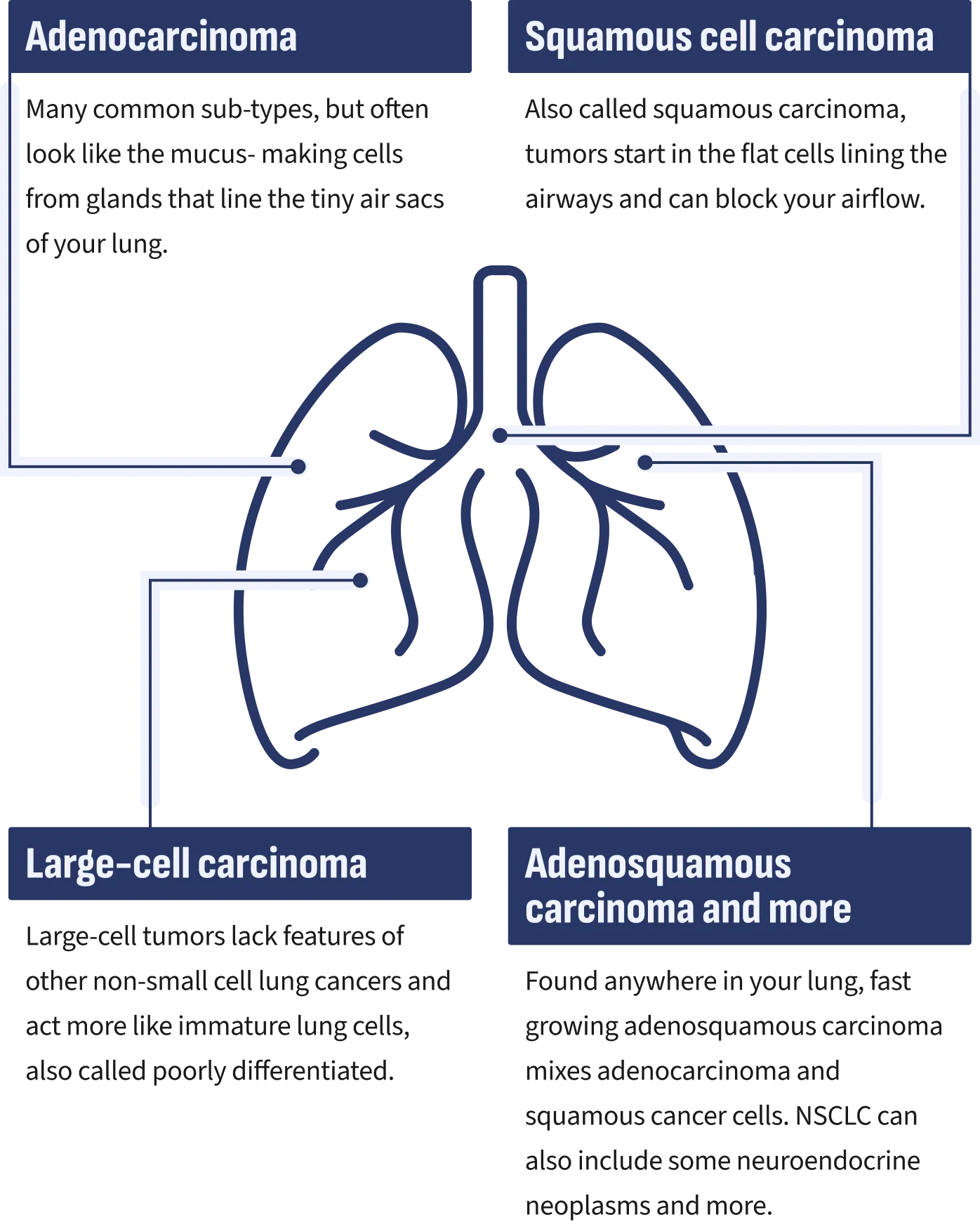 infographic