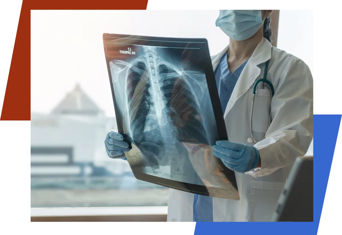 Doctor holding lung X-ray